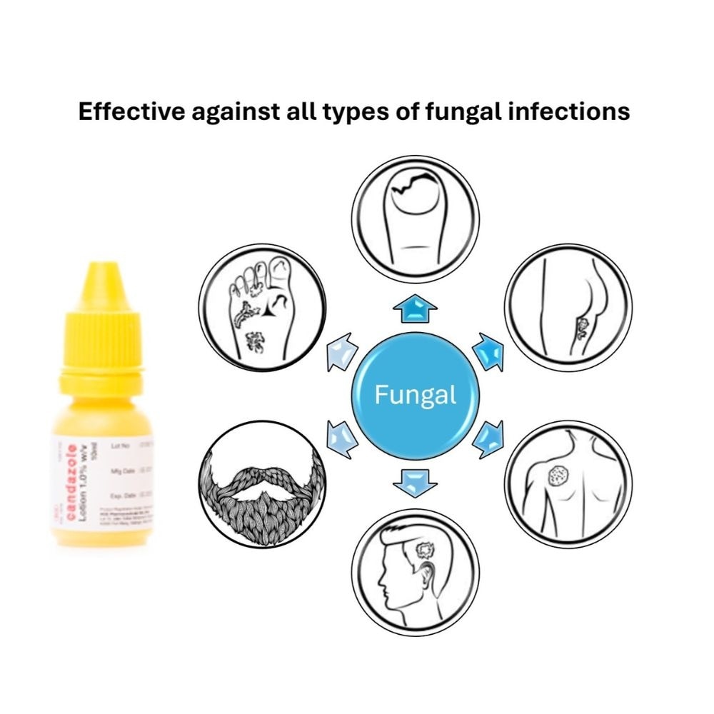 Fungal Infection Lotion 10ml