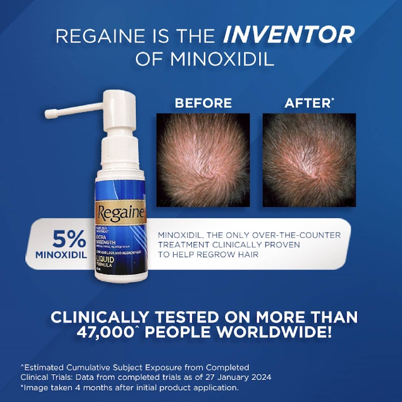 Extra Strength Minoxidil Topical Solution 5% W/V Solution(For Hair Regrow & Hair Loss Treatment) 60ml