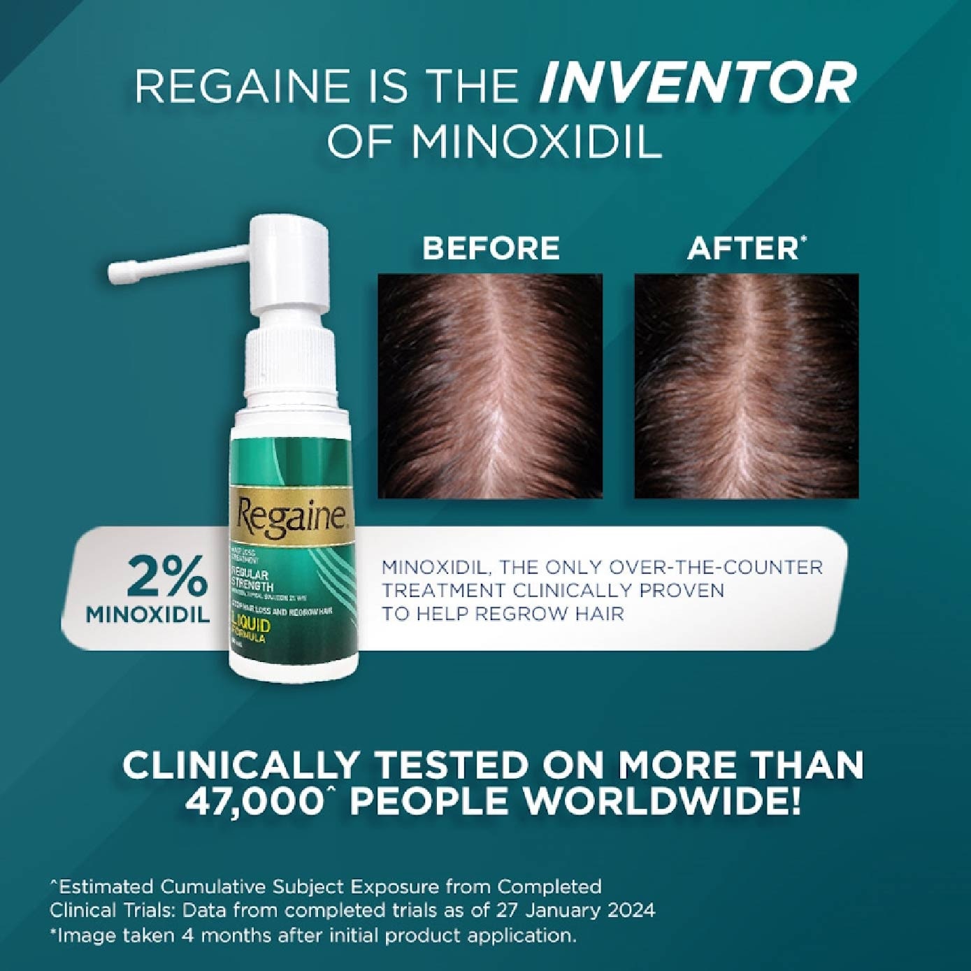 Regular Strength Minoxidil Topical Solution 2% W/V Solution (For Hair Regrow & Hair Loss Treatment) 60ml