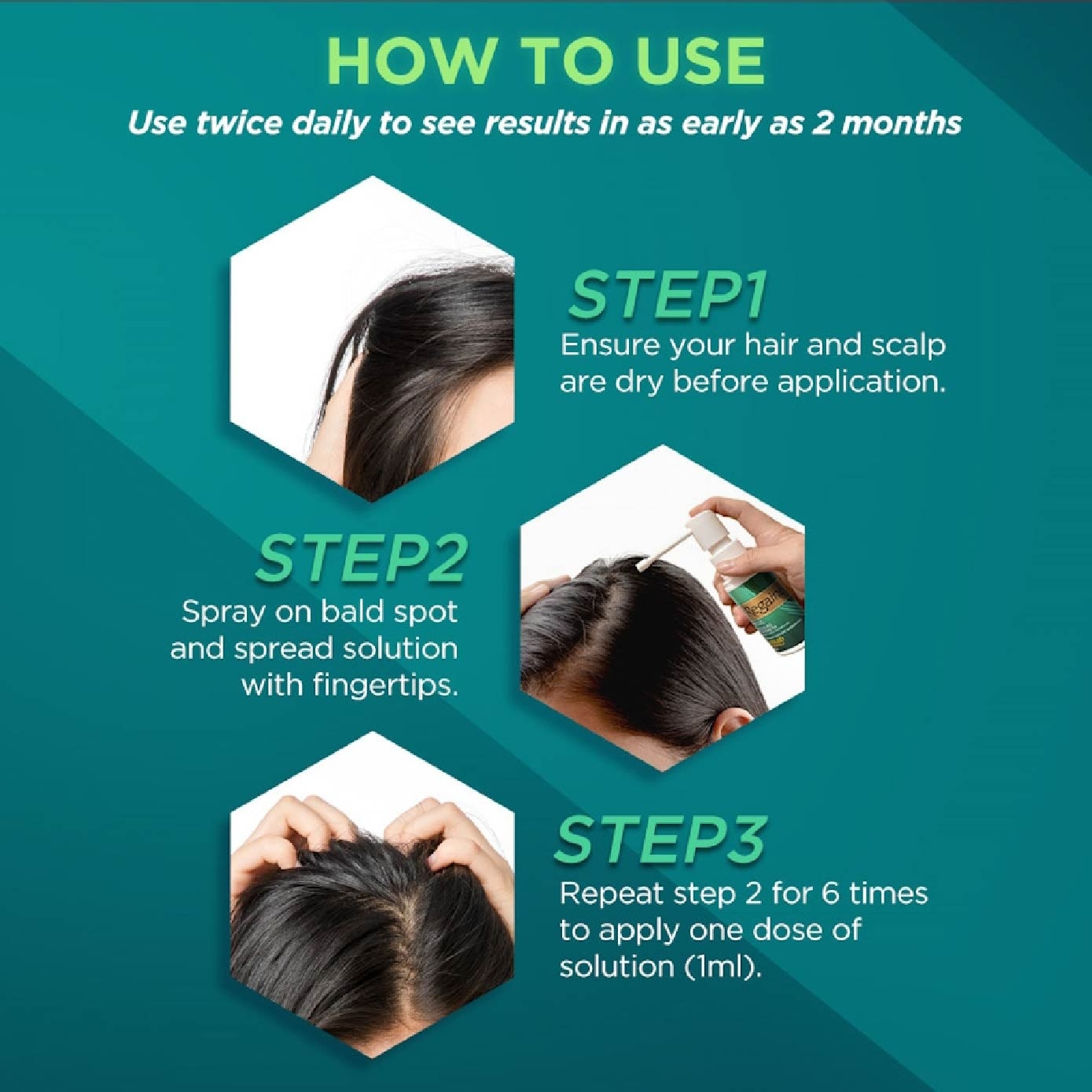 Regular Strength Minoxidil Topical Solution 2% W/V Solution (For Hair Regrow & Hair Loss Treatment) 60ml