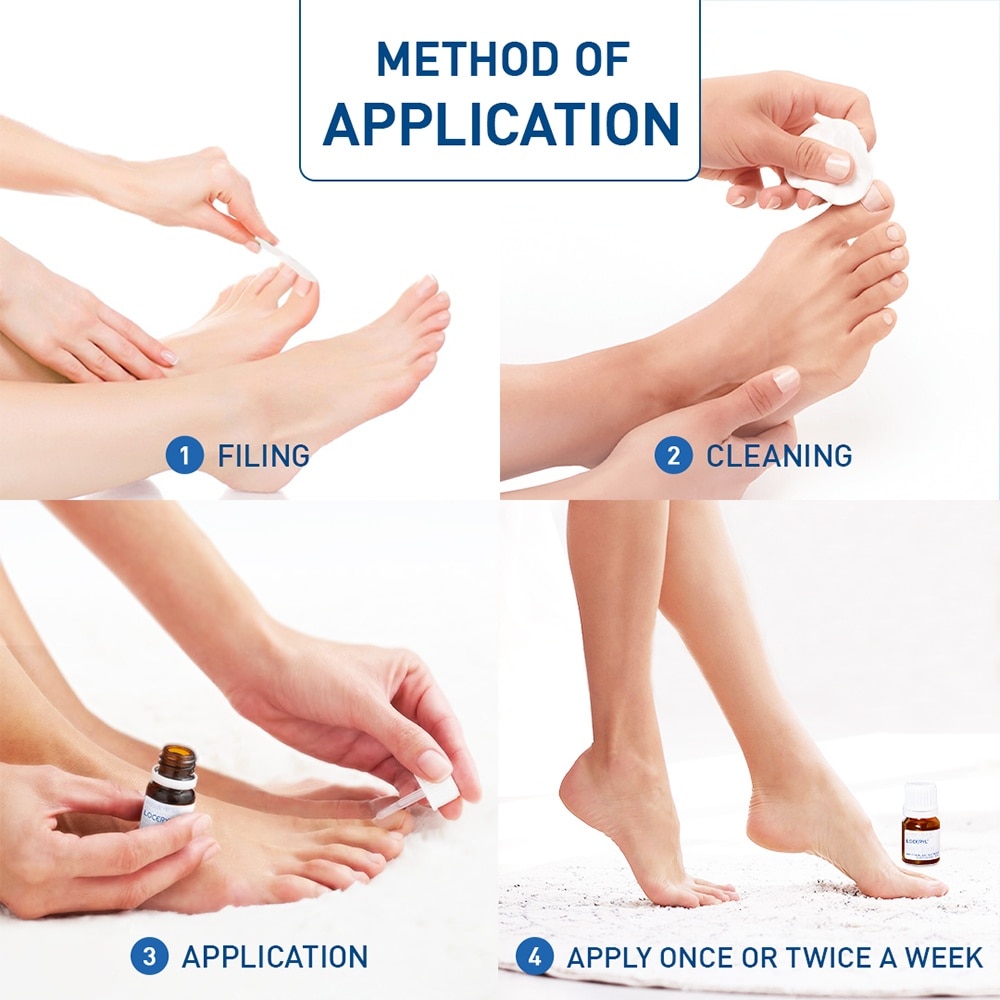 Loceryl Anti-Fungal Nail Treatment (5% W/V Amorolfine Medicated Nail Lacquer) 2.5ml