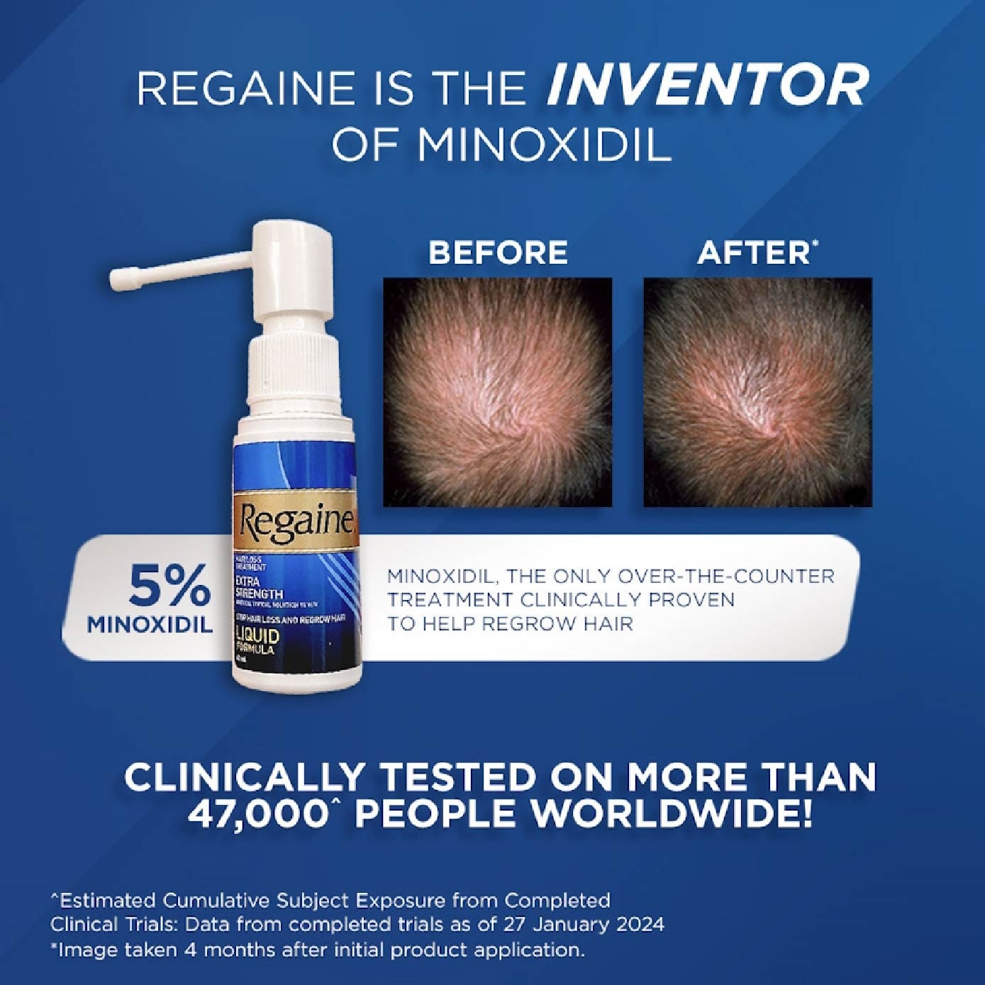 Extra Strength Minoxidil Topical Solution 5% W/V Solution 60ml Packset x 2s
