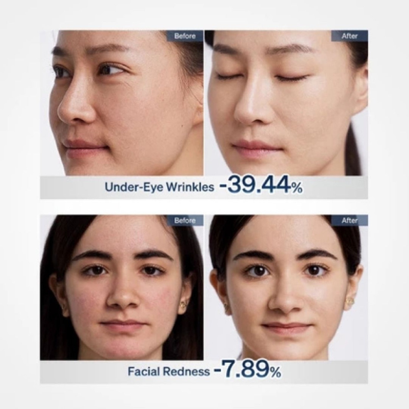 ReGlow LED Face Mask 1s