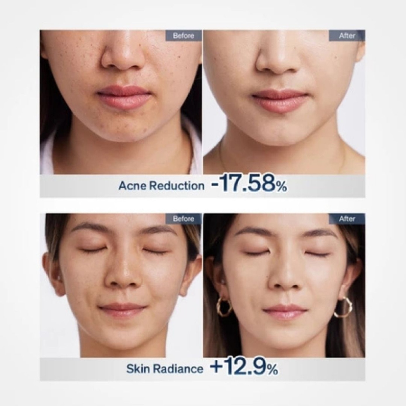 ReGlow LED Face Mask 1s