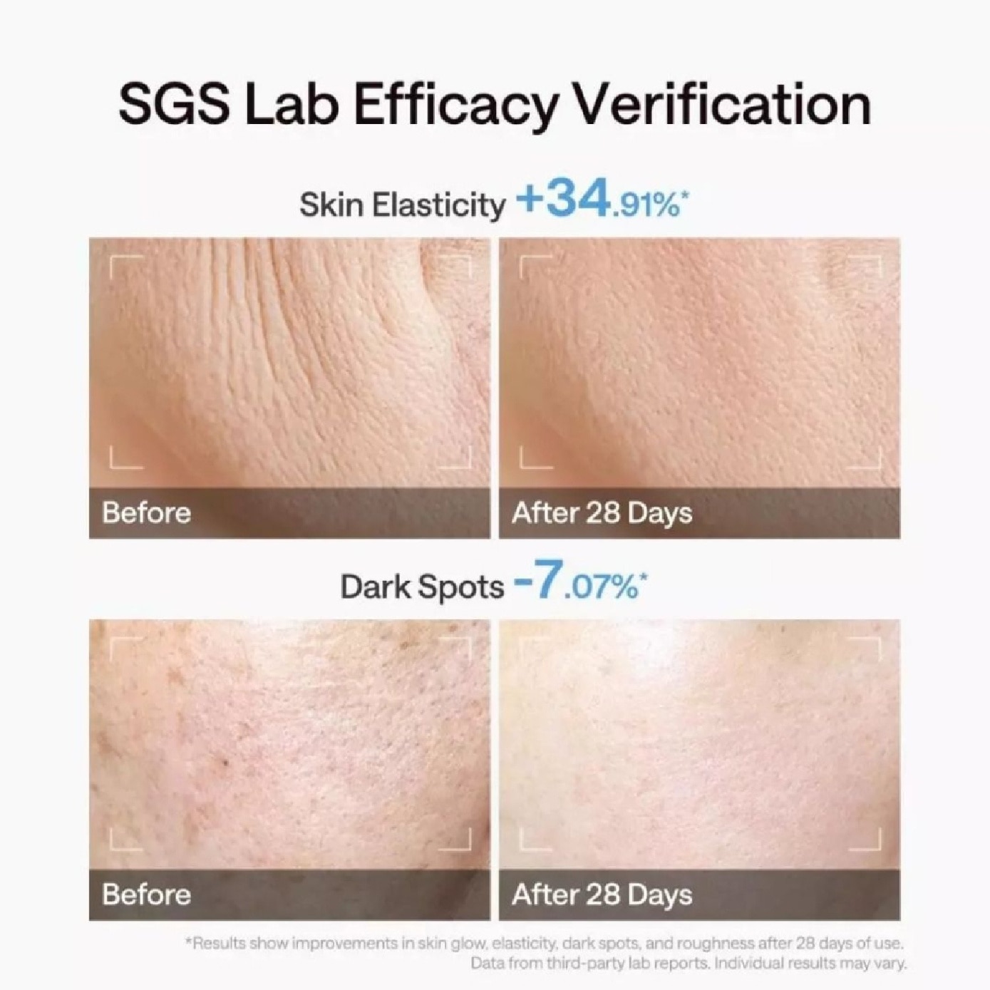 Clear Pro DPL NRI Beauty Device 1s