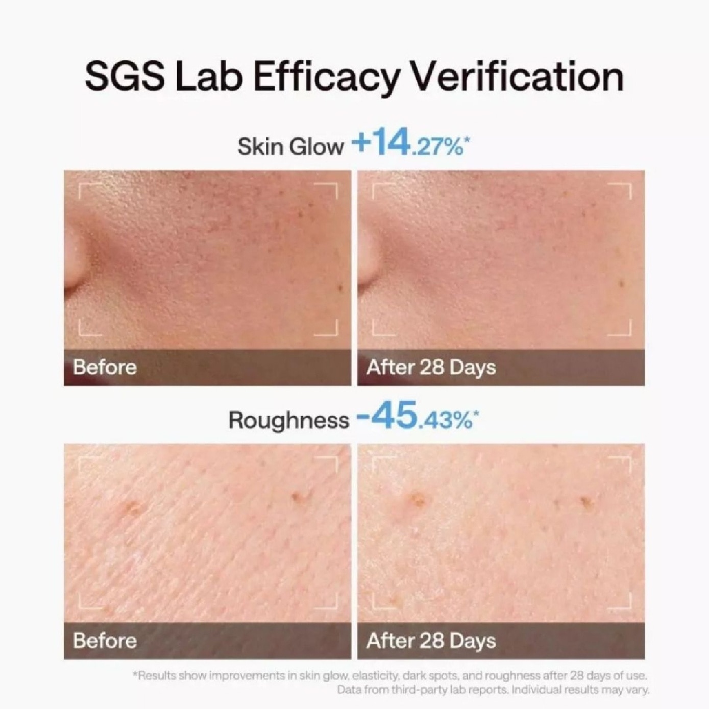 Clear Pro DPL NRI Beauty Device 1s