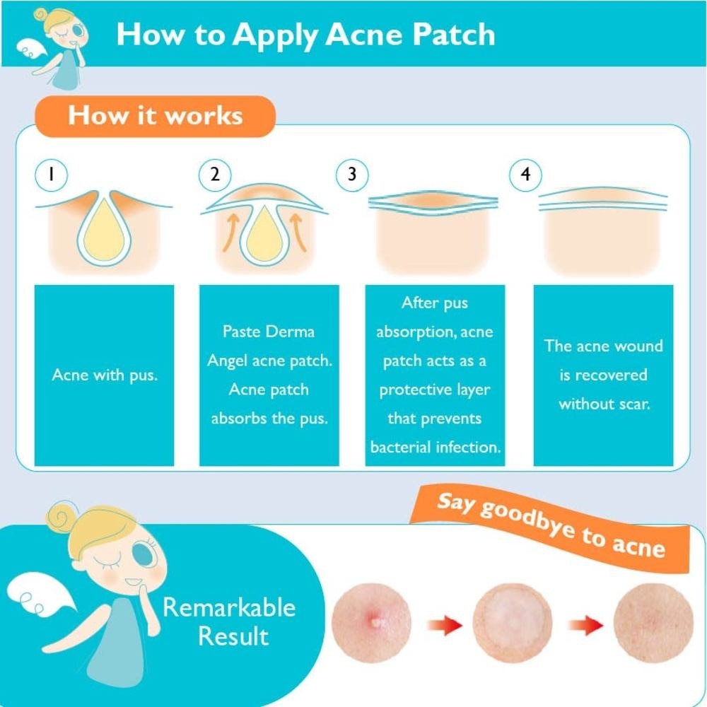 Acne Patch Plus with Salicylic Acid Fast Clearing Ultra Thin Edge (Easy Removal) Day 12s