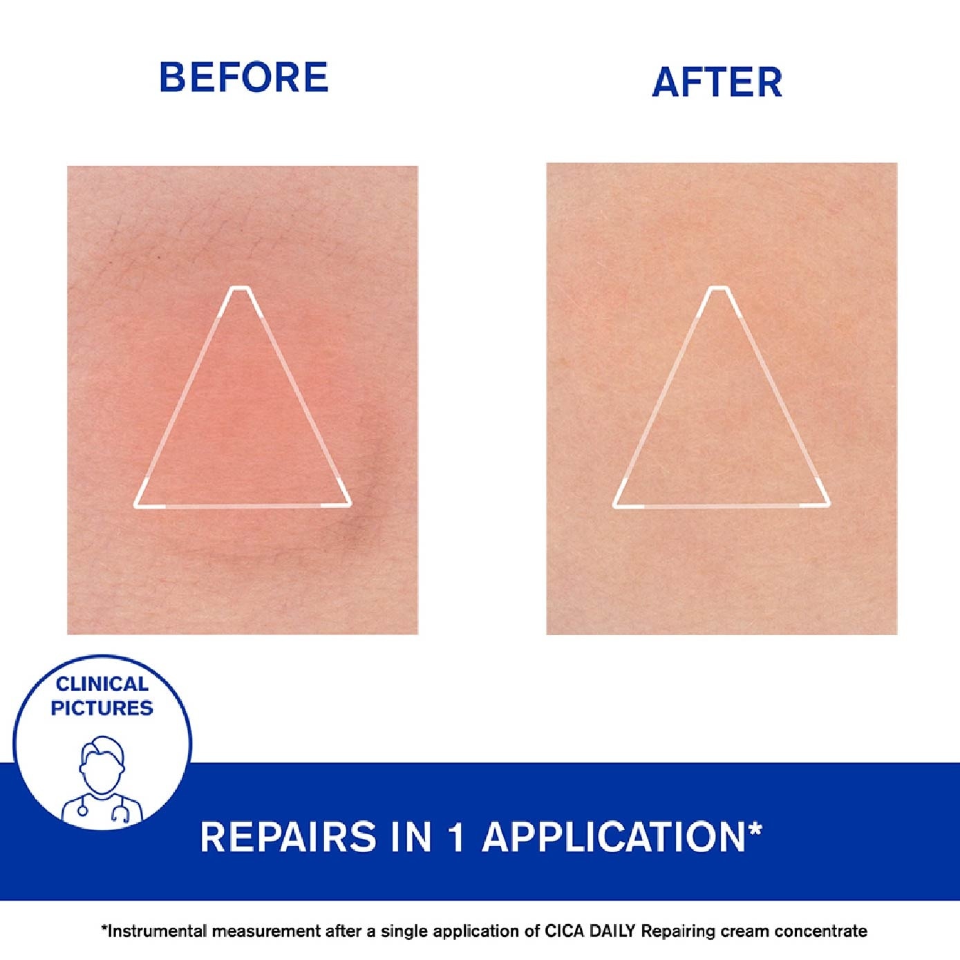 Bariederm Cica Daily Gel Cream 40ml