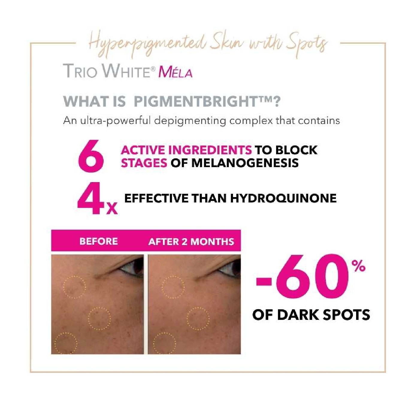 Trio White Mela Anti-Dark Spot Night Care Moisturiser 50ml