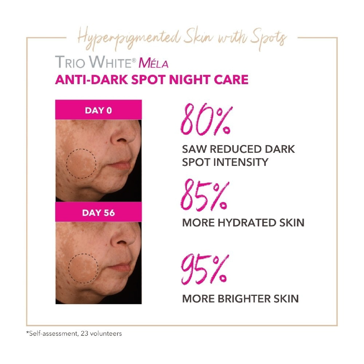 Trio White Mela Anti-Dark Spot Night Care Moisturiser 50ml