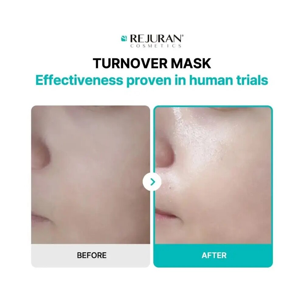 REJURAN Turnover Mask 5s | Face | Watsons Singapore