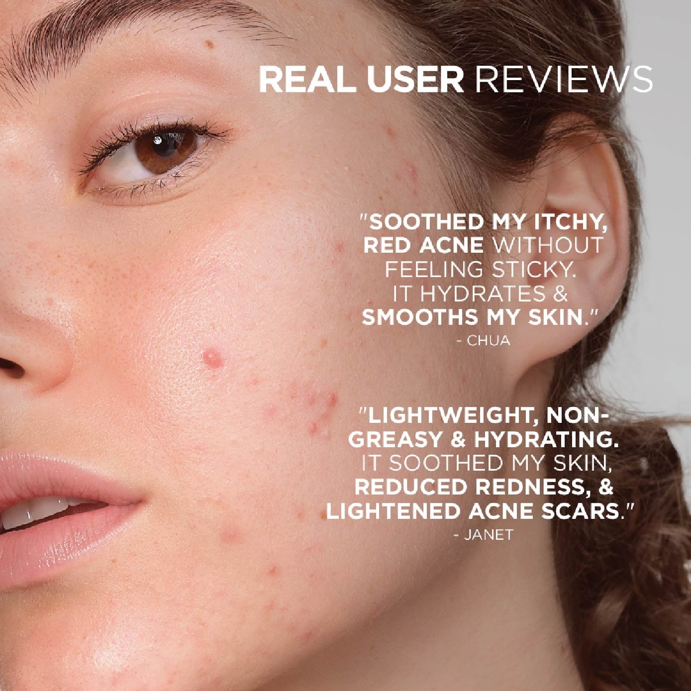 Sebium Sensitive Soothing Acne Moisturiser 30ml image