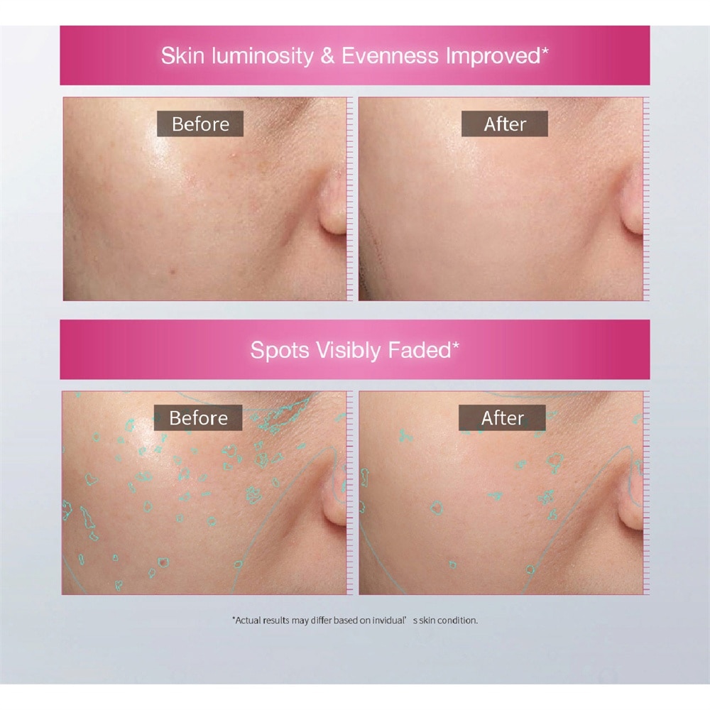 Glutalight C Intensive Brightening Serum 15ml