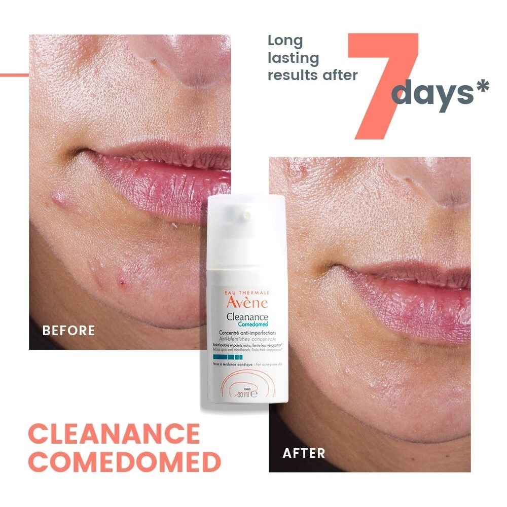 Cleanance Comedomed 30ml