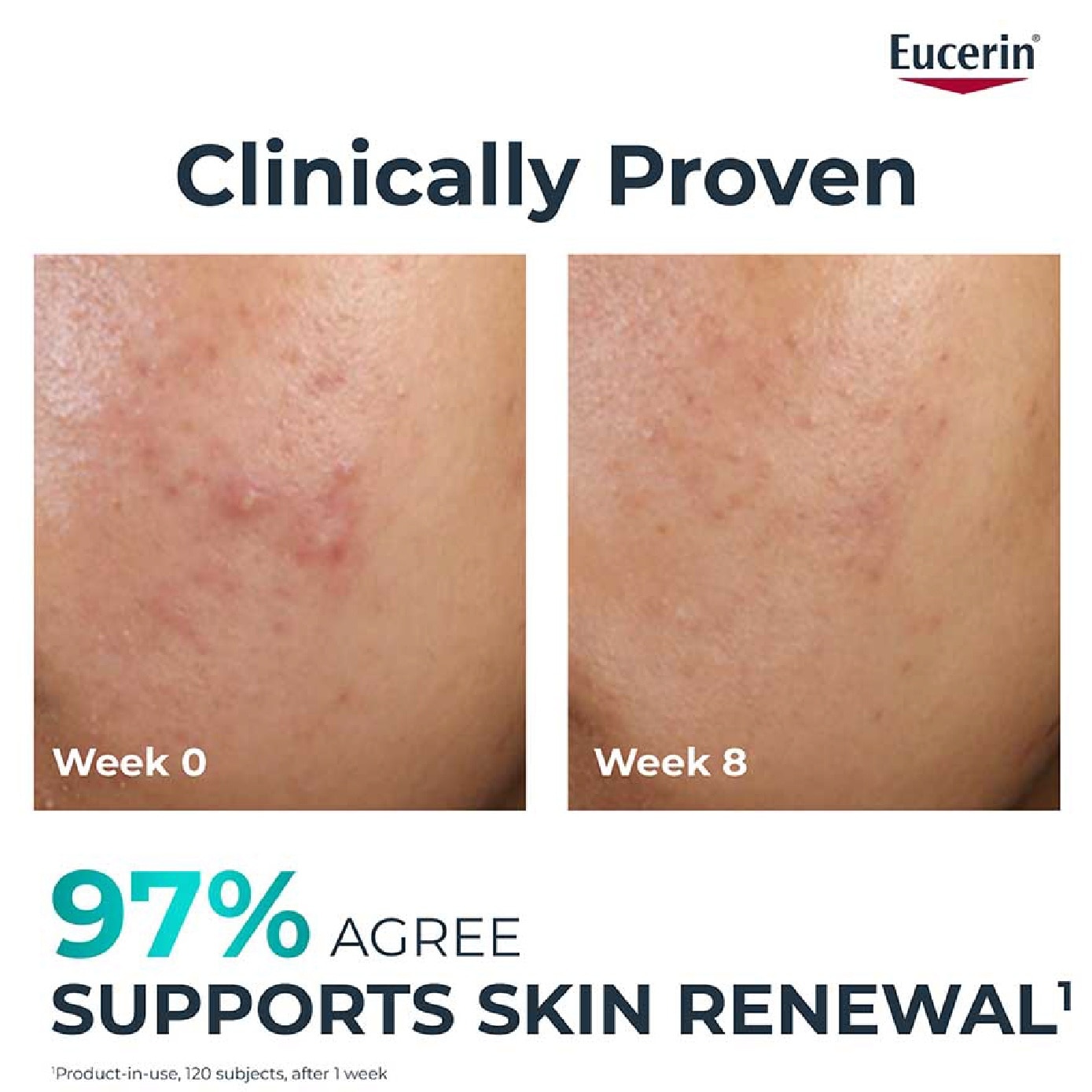 Dermopure Clinical Peeling 10 40ml