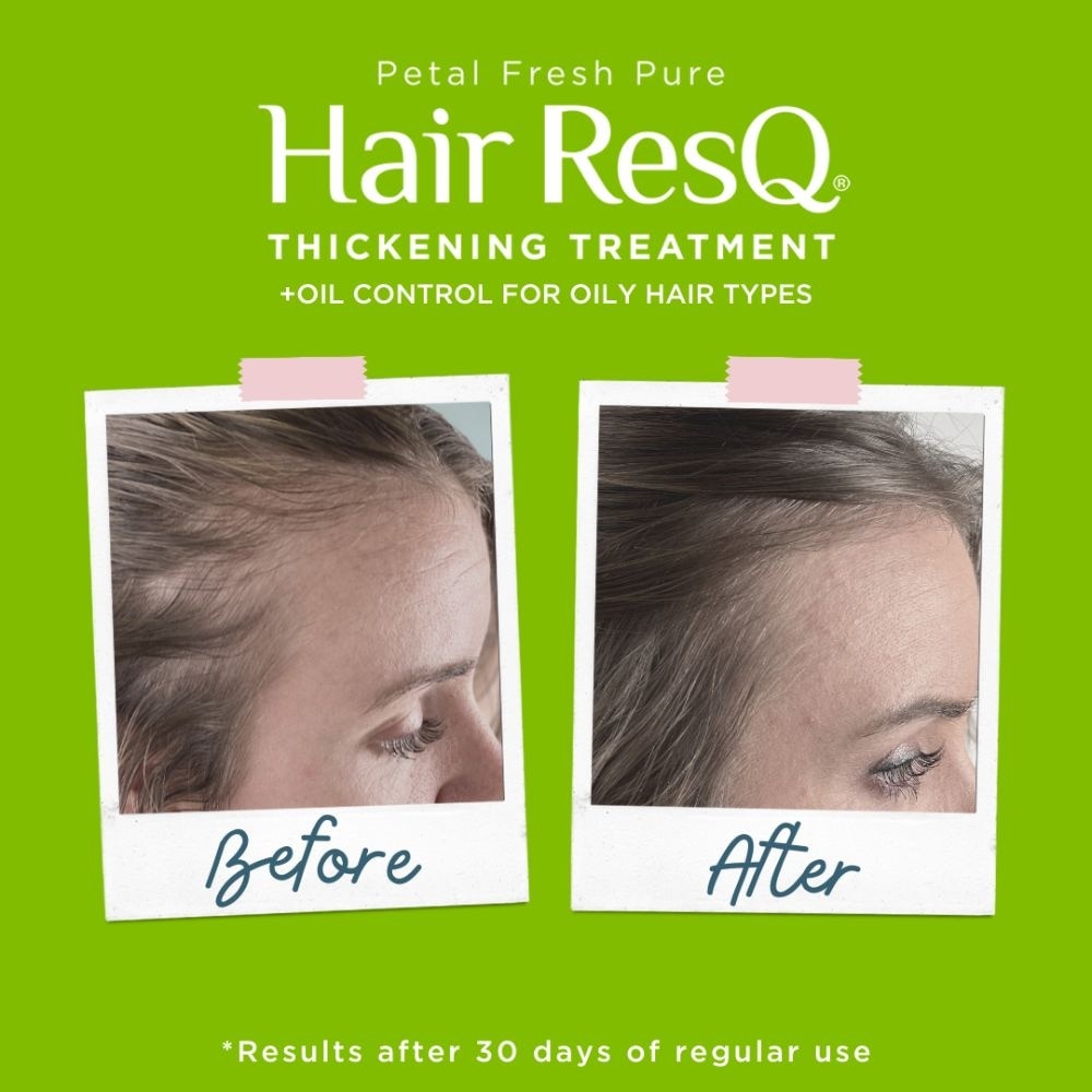 Hair ResQ Thickening + Oil Control Treatment Biotin Shampoo 355ml