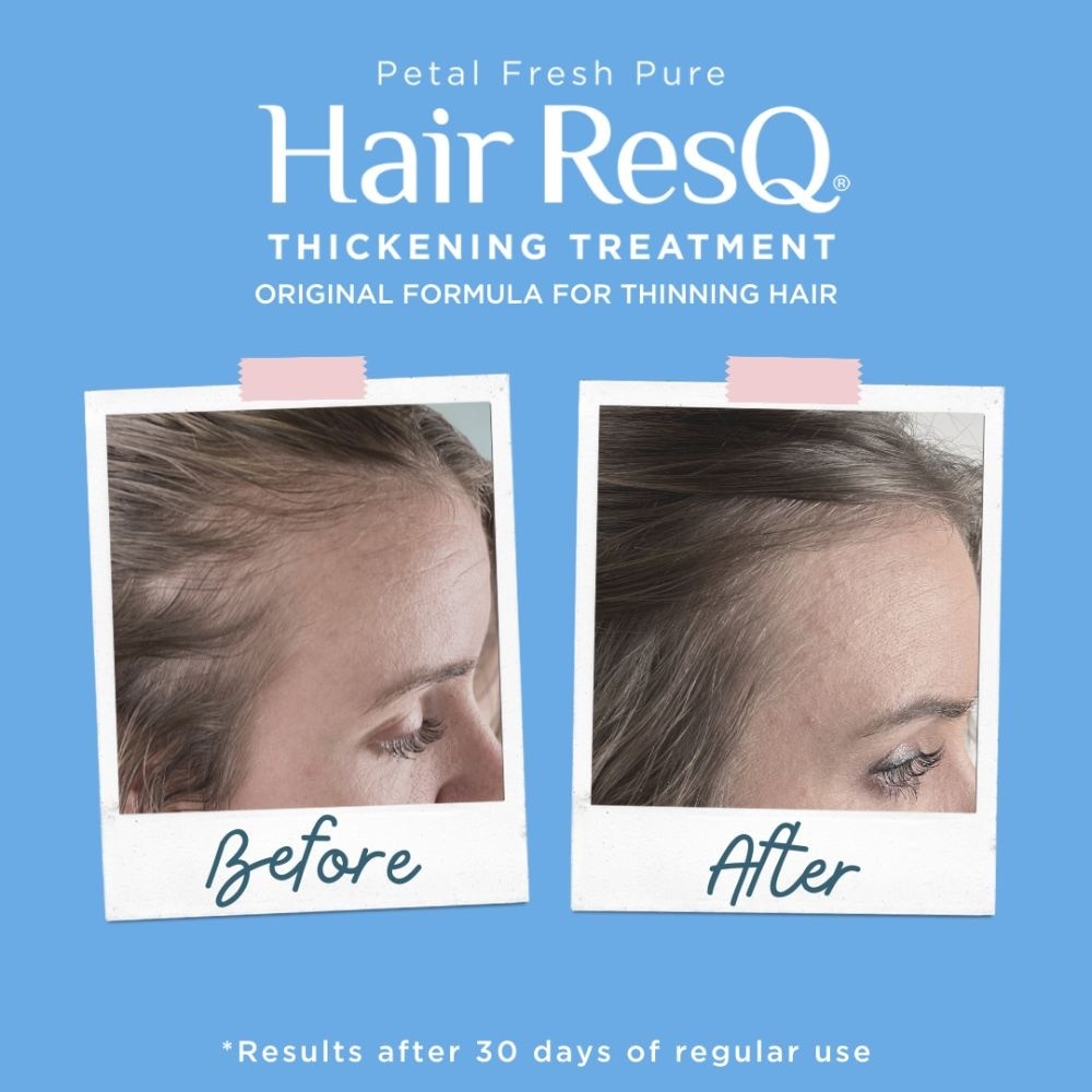 Hair ResQ Thickening Treatment Original Formula Weightless Conditioner 355ml