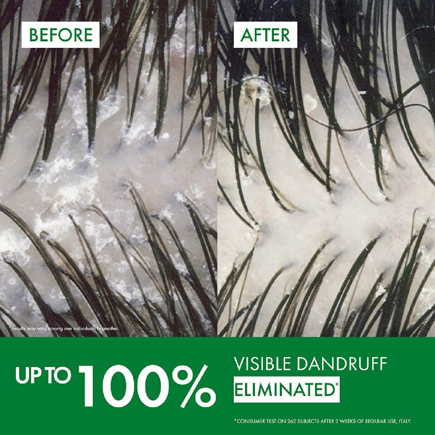 DERCOS Anti-Dandruff Normal to Oily Hair Shampoo 95ml image