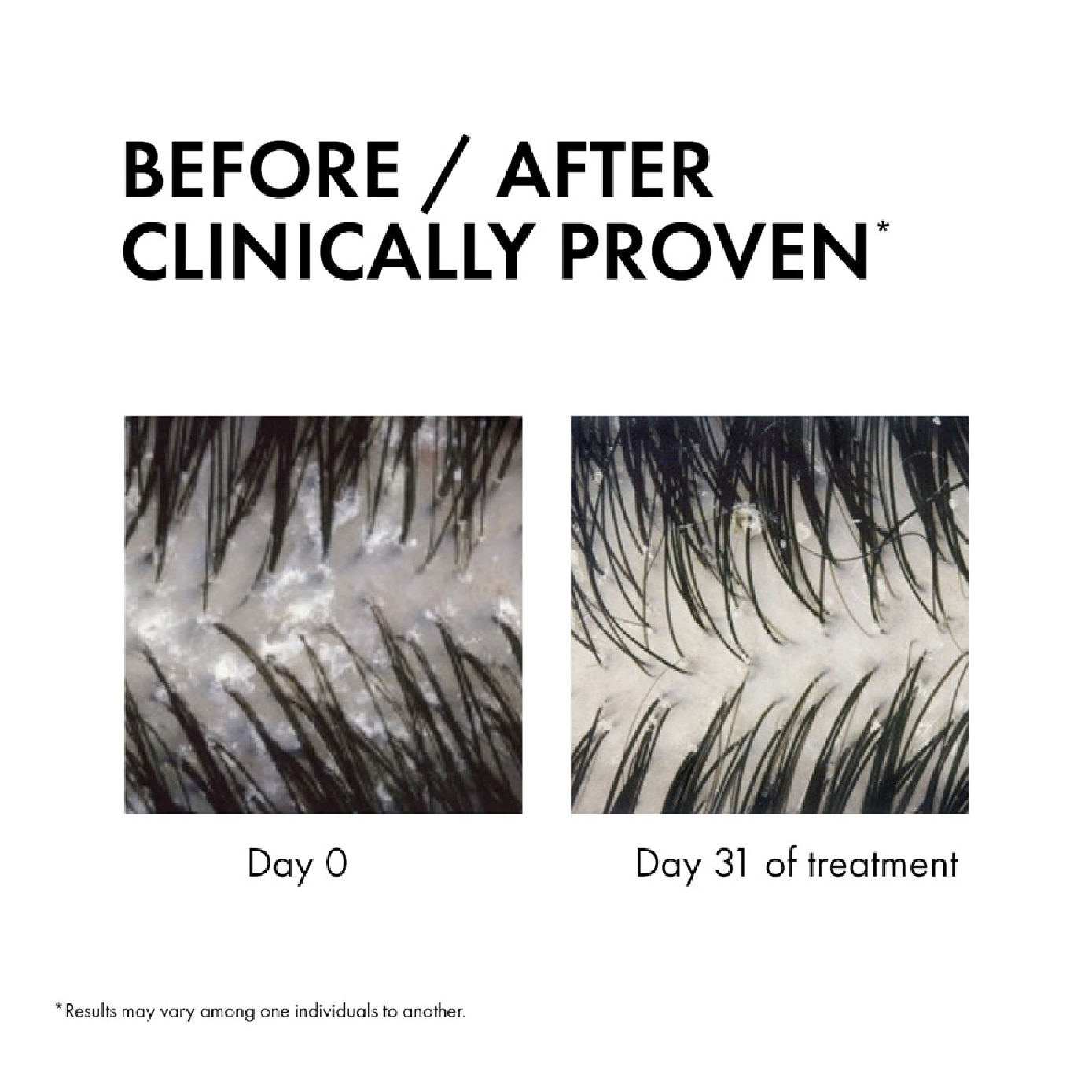 DERCOS Anti-Dandruff 2 in 1 Conditioning Shampoo 200ml