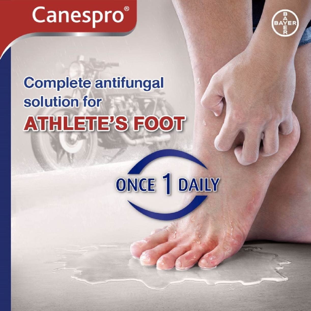 Bifonazole Anti-Fungal Cream 1% (Treatment For Athelete's Foot + Fungal Skin Conditions) 15g