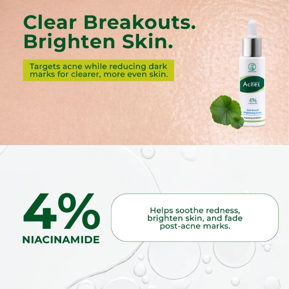 Anti-Acne & Brightening Serum 30ml