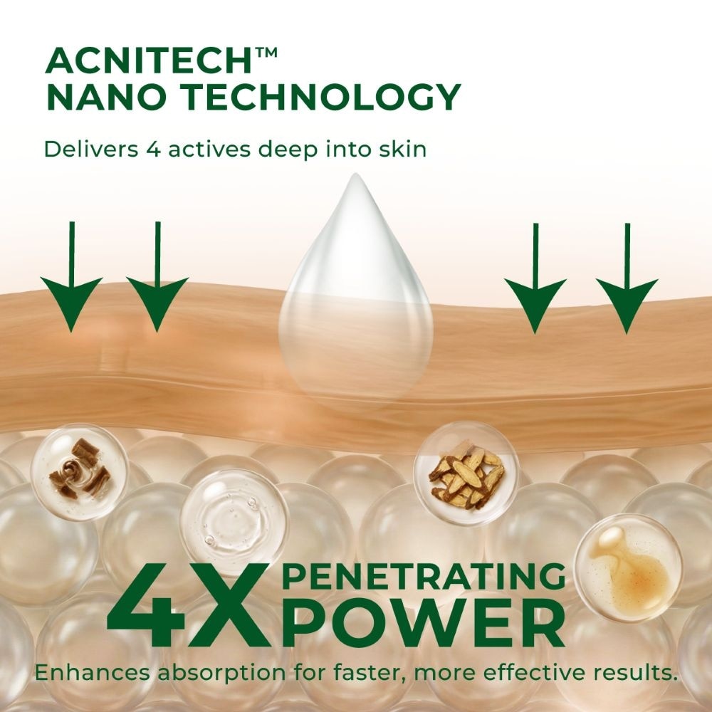 Anti-Acne & Brightening Serum 30ml
