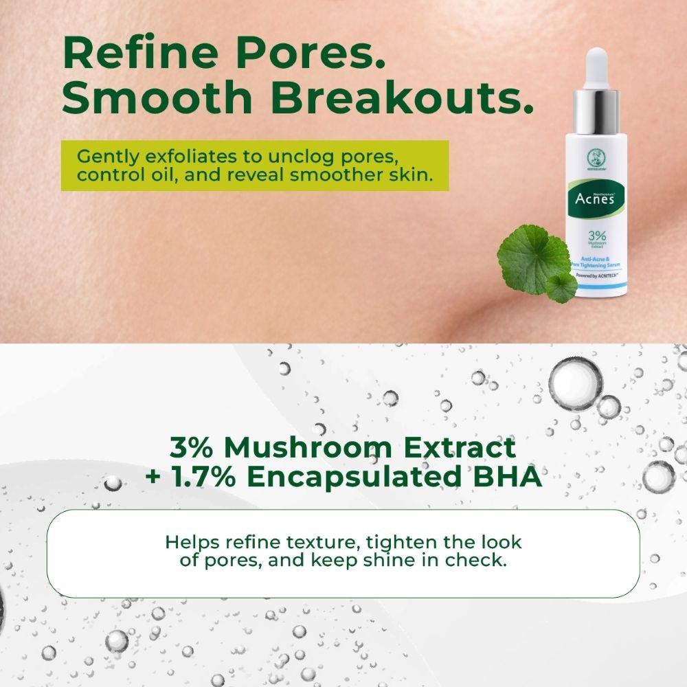 Anti-Acne & Pore Tightening Serum 30ml