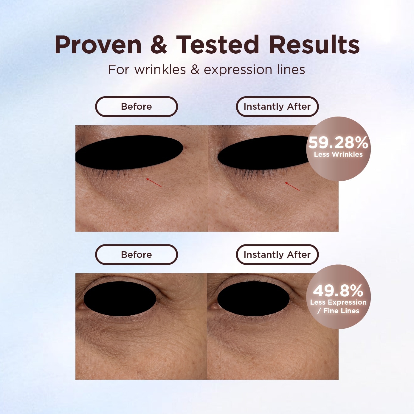 Pure NMN+ Exosome Youth Renew Eyecream 15g image
