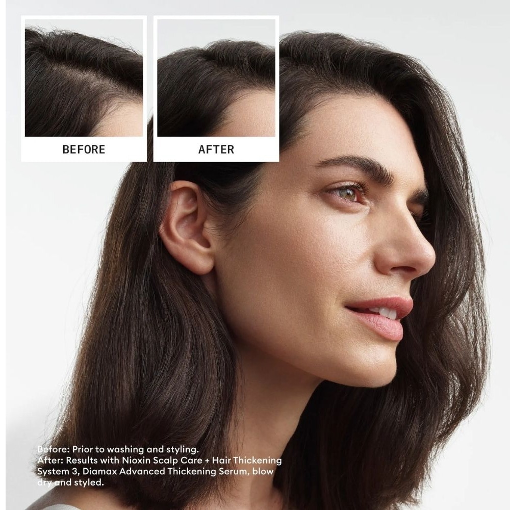 System 3 Scalp Care + Hair Thickening Leave-In Treatment 100ml