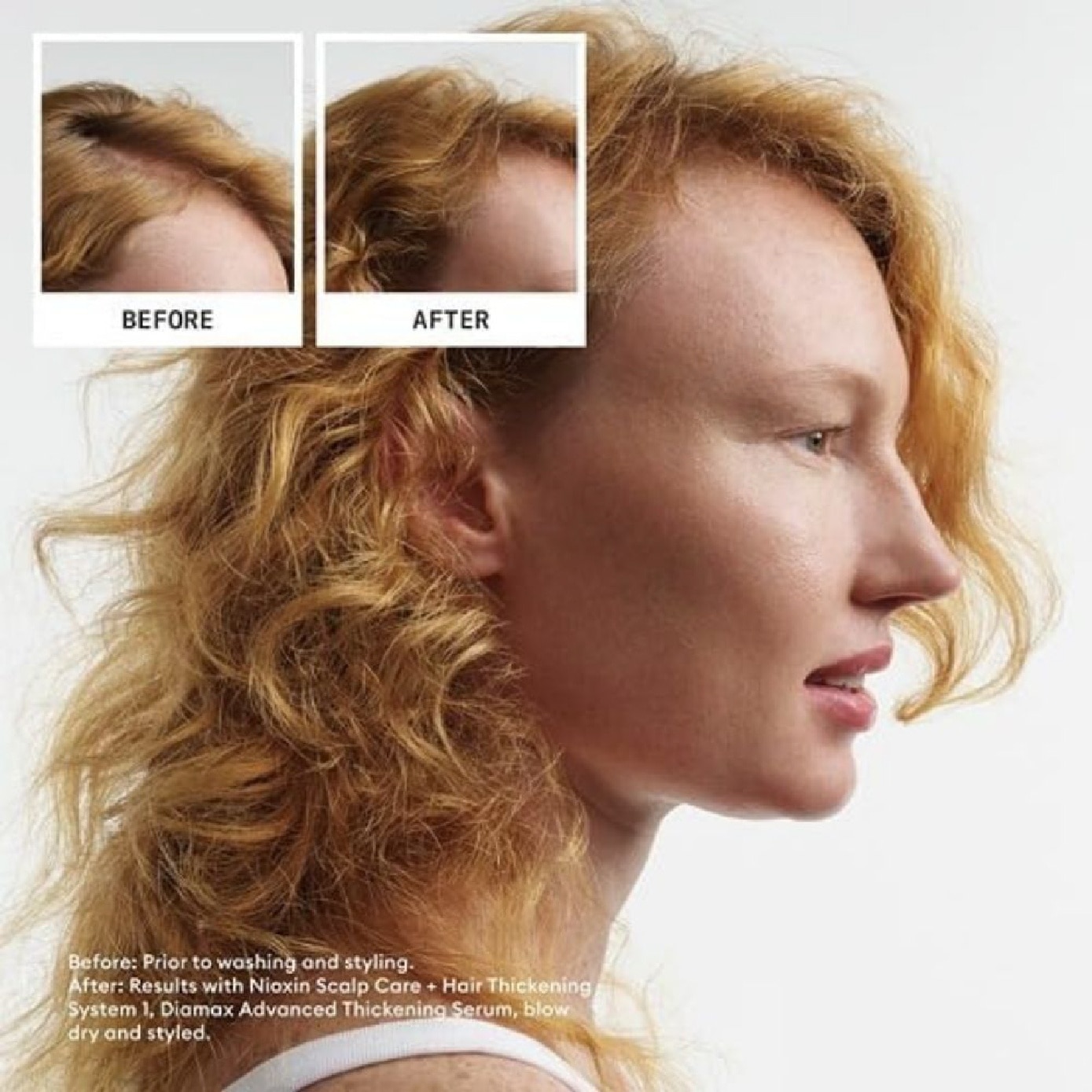 System 1 Scalp + Hair Kit consists Shampoo 150ml + Conditioner 150ml + Treatment 50ml