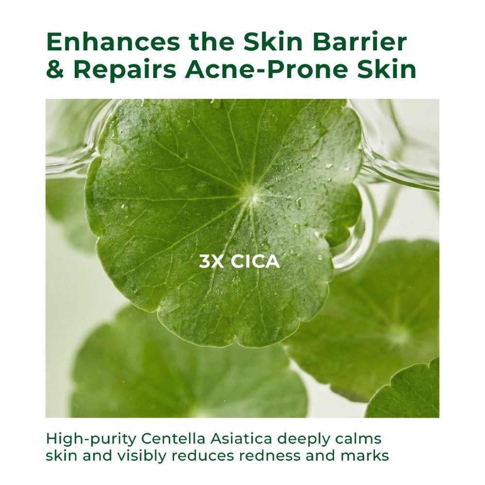 Anti-Acne & Soothing Facial Mask 5s