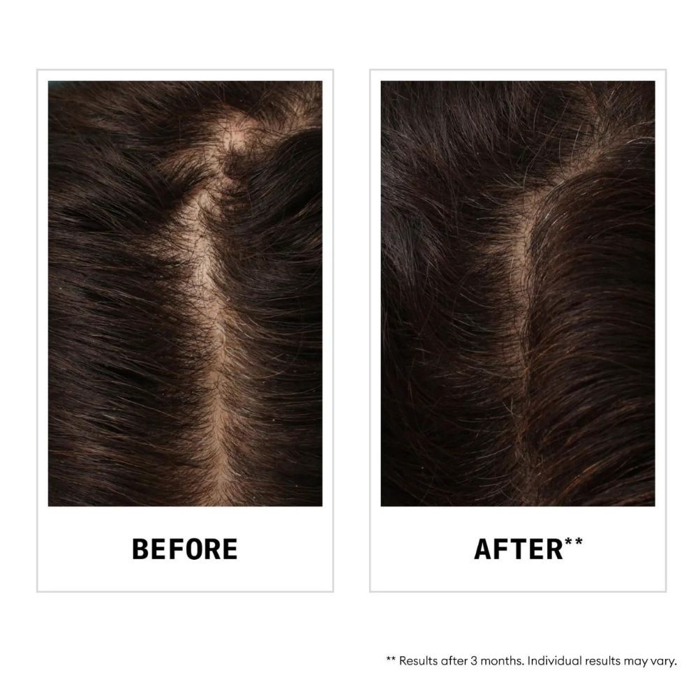 Anti-Hair Loss Shampoo 240ml