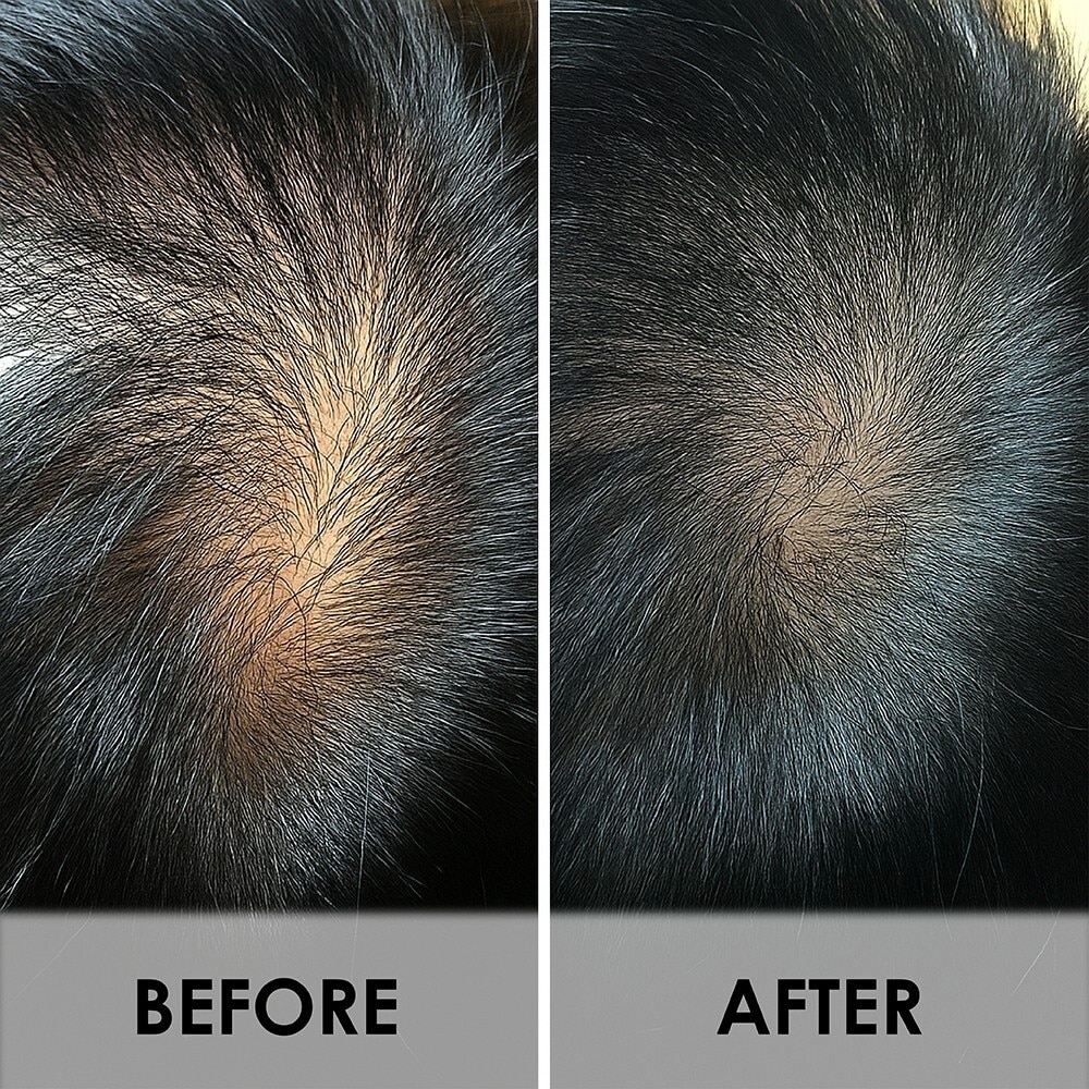 True Scalp Tonic 100ml