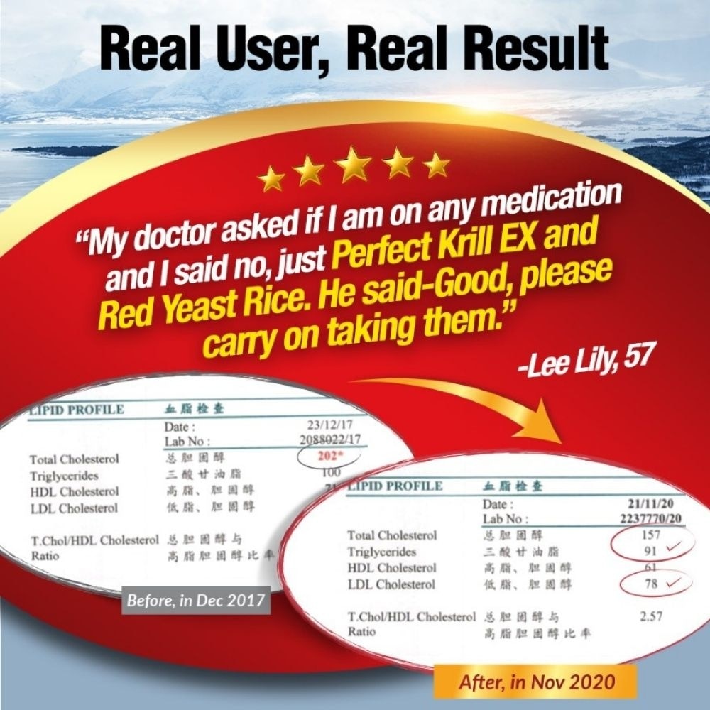 Perfect Krill EX Superba Boost Antarctic with Krill Oil Omega 3 & Phospholipids Softgel (Cholesterol, Heart, Brain, Joint Health) 60s