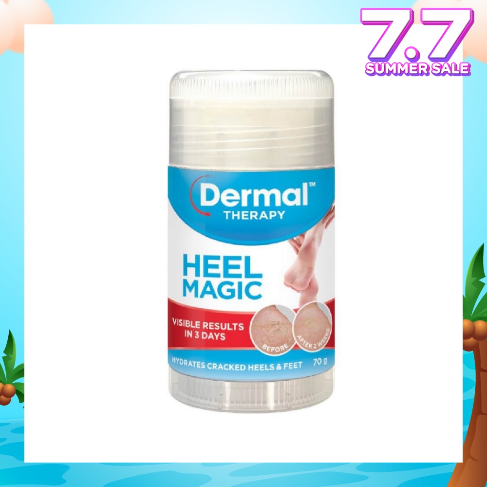 Heel Magic 70g (Expiry: Nov`2025)