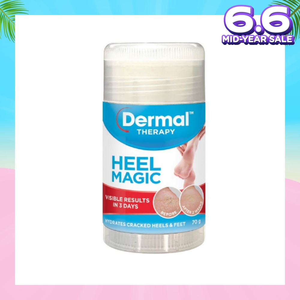 Heel Magic 70g (Expiry: Nov`2025)