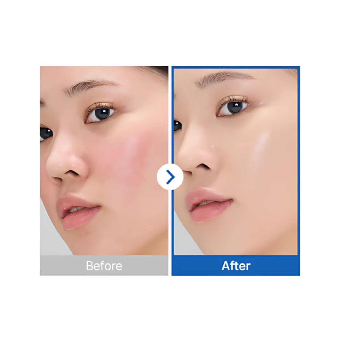 Glacial Marine Algae-PDRN Serum 30ml