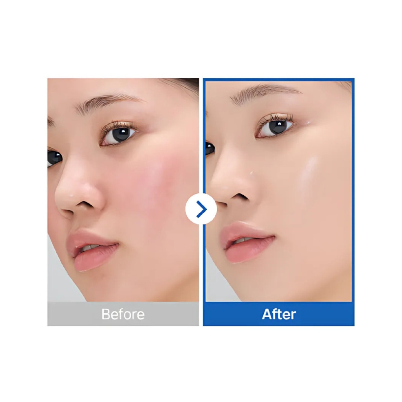 Glacial Marine Algae-PDRN Gel Mask 5s