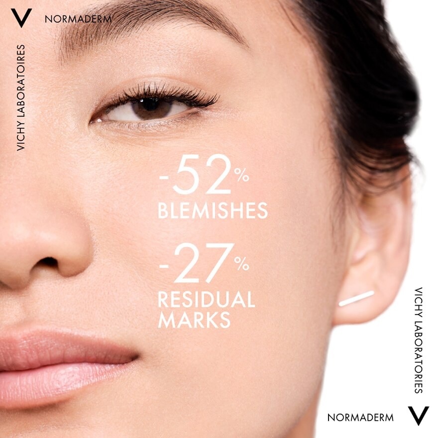 Vichy Normaderm Beautifying Anti-Blemish Care 50ml