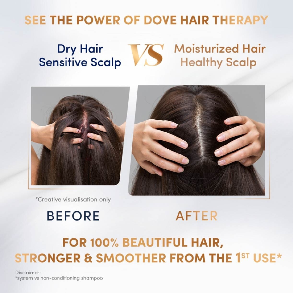 Dove Hair Therapy Sensitive Scalp Care Serum + Conditioner 230ml (For Dry Hair & Sensitive Scalp)