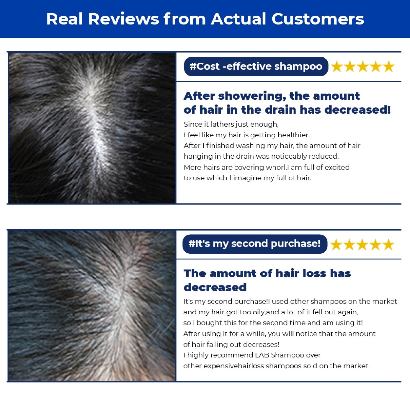 Lab Shampoo for Anti-Hair Loss 1000ml