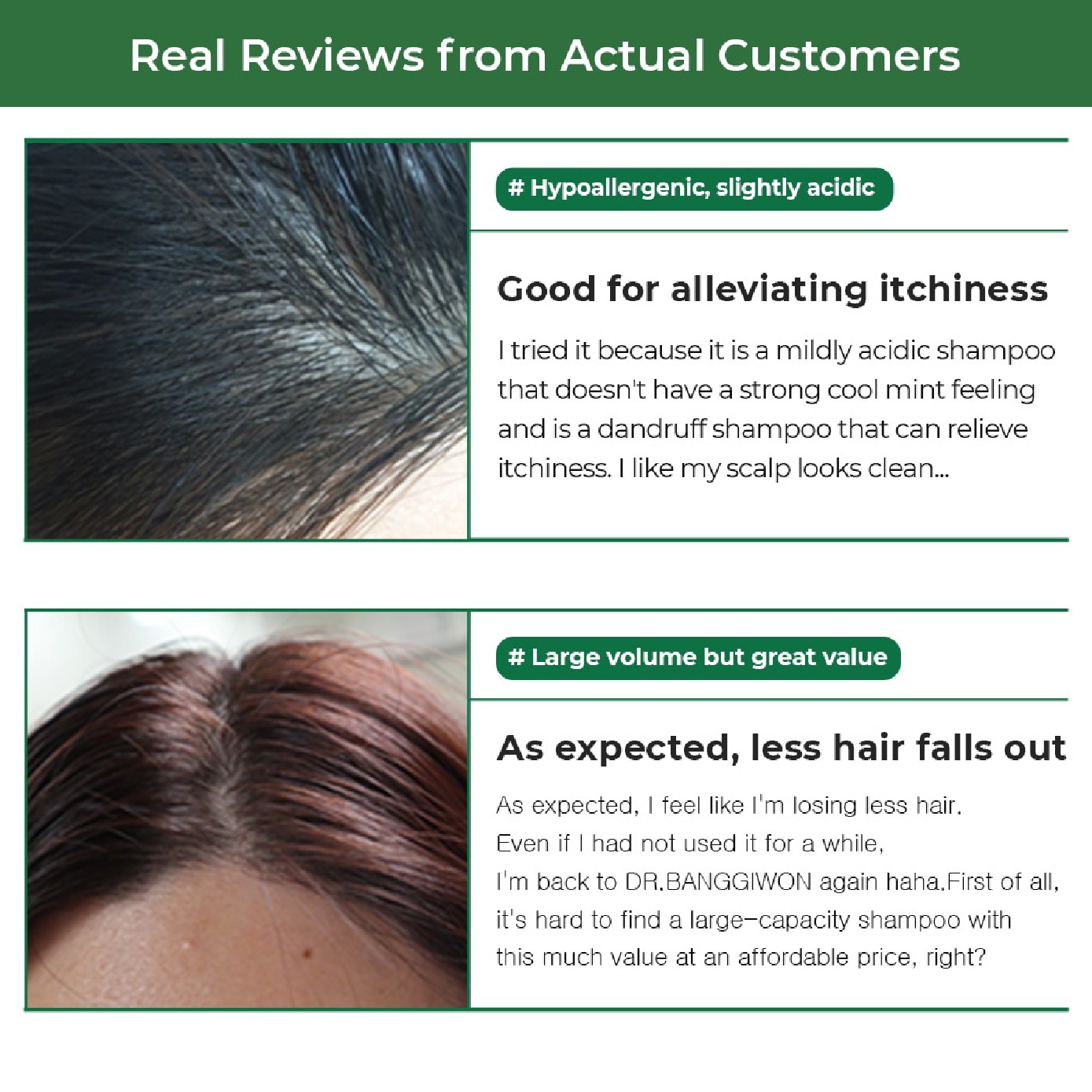 Dandruff Shampoo for Anti-Hair Loss 1000ml