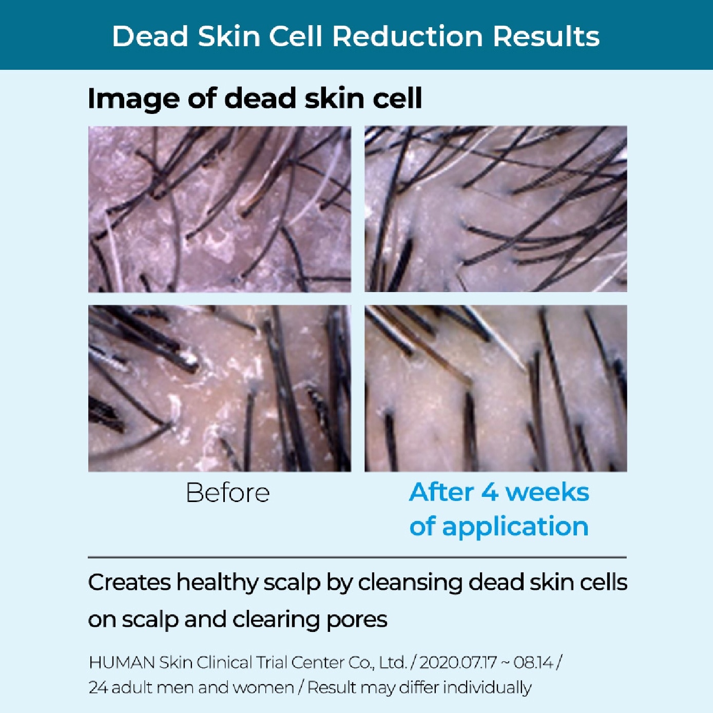 Cool Shampoo for Anti-Hair Loss 1000ml
