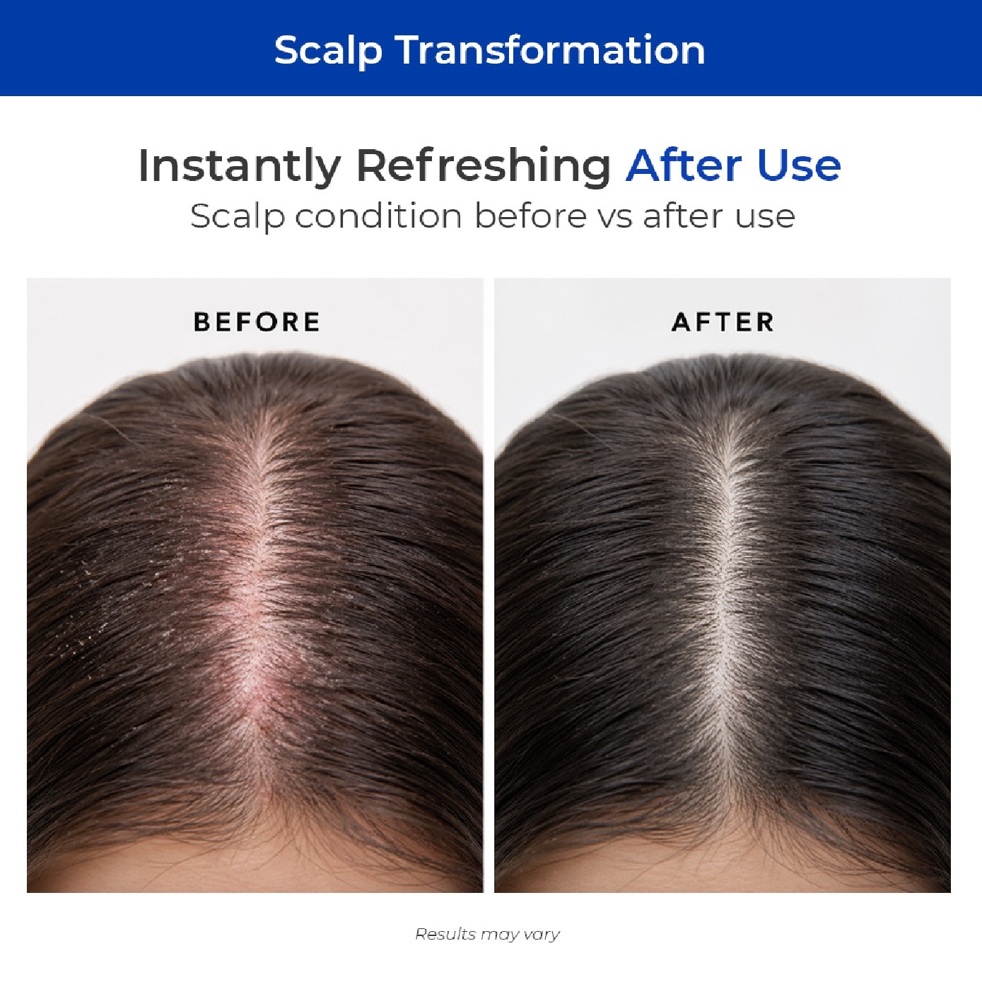 Lab Hair Tonic for Anti-Hair Loss 150ml
