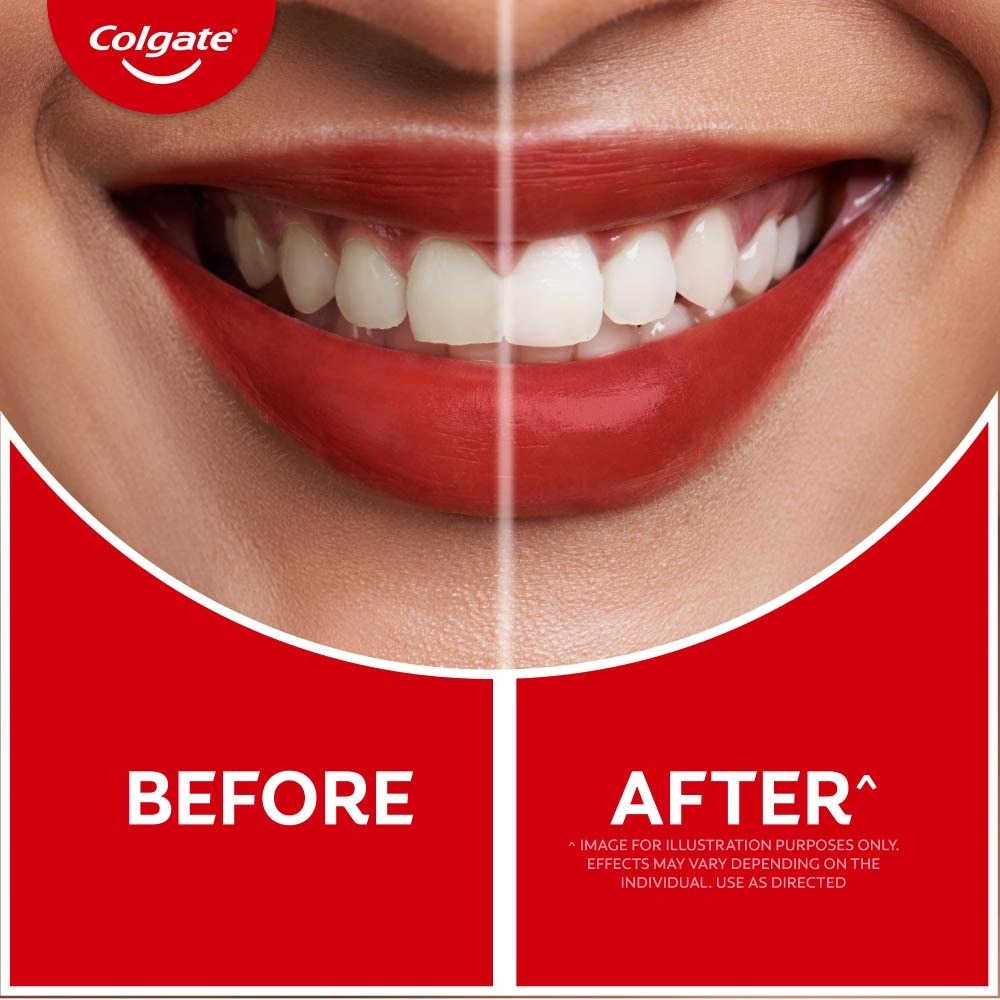 Optic White O2 Teeth Whitening Pen 1s