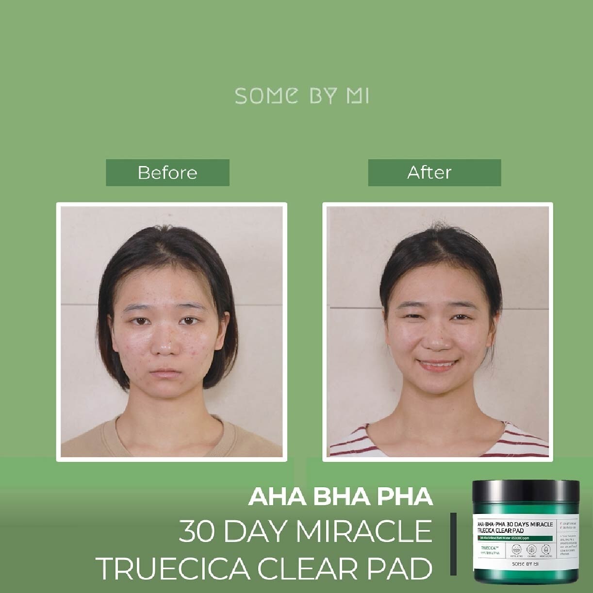 30 DAYS Miracle Truecica Anti-Acne Clear Pad 70s