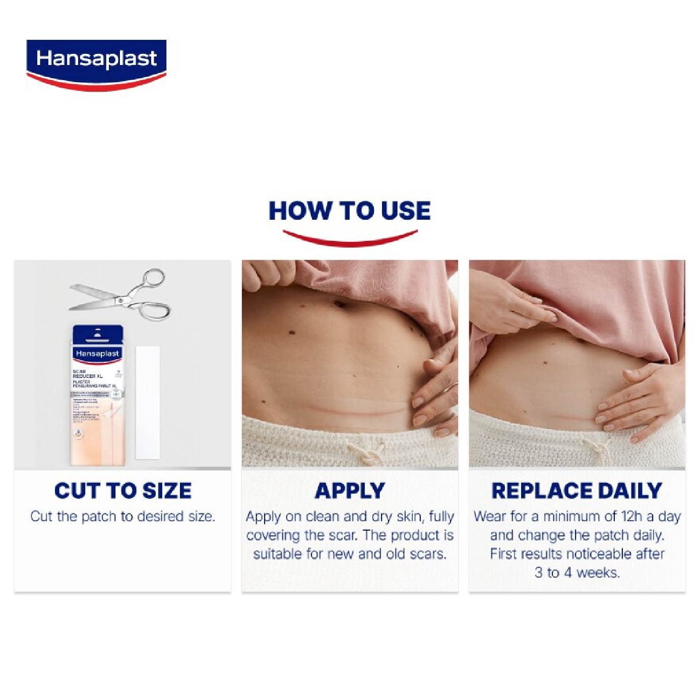 Scar Reducer Plaster 21s Bundle Set 1s