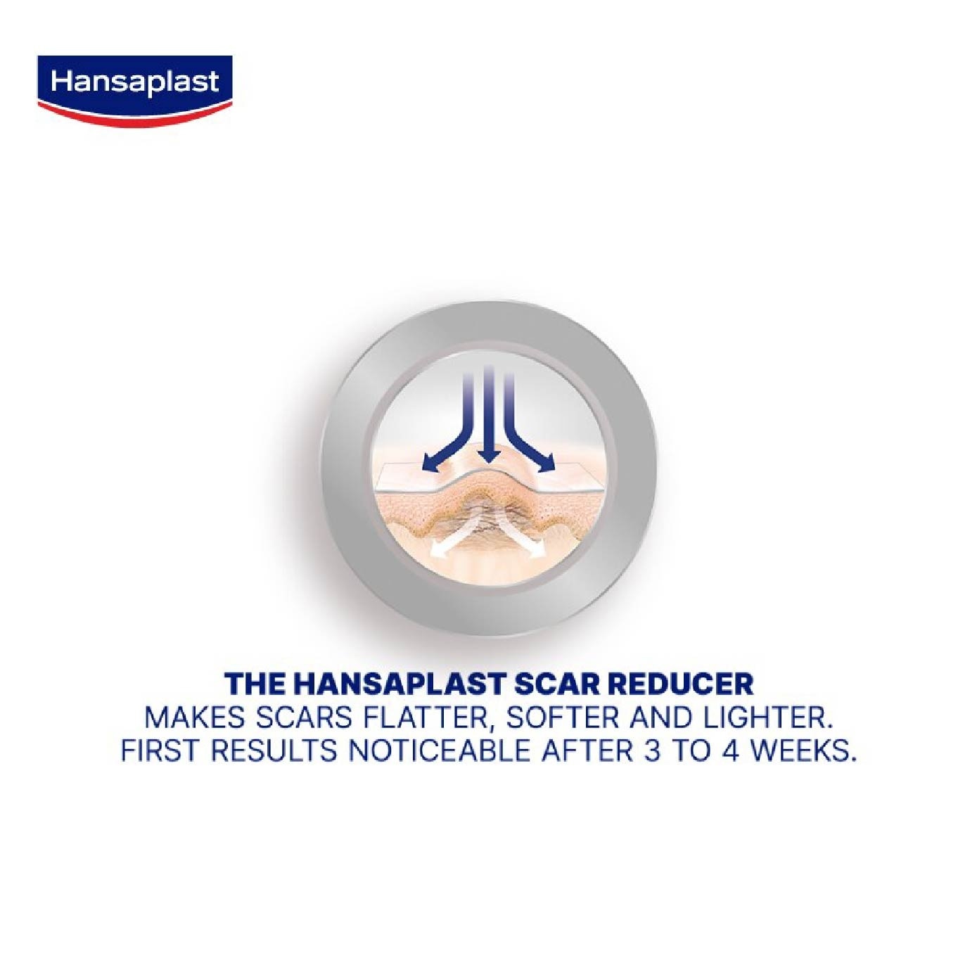 Transparent Scar Reducer XL Plaster 21s Bundle Set 1s