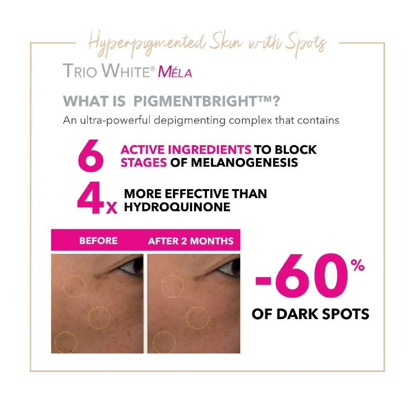 Trio White Mela+ Anti-Dark Spot Day Cream SPF 50+ 40ml