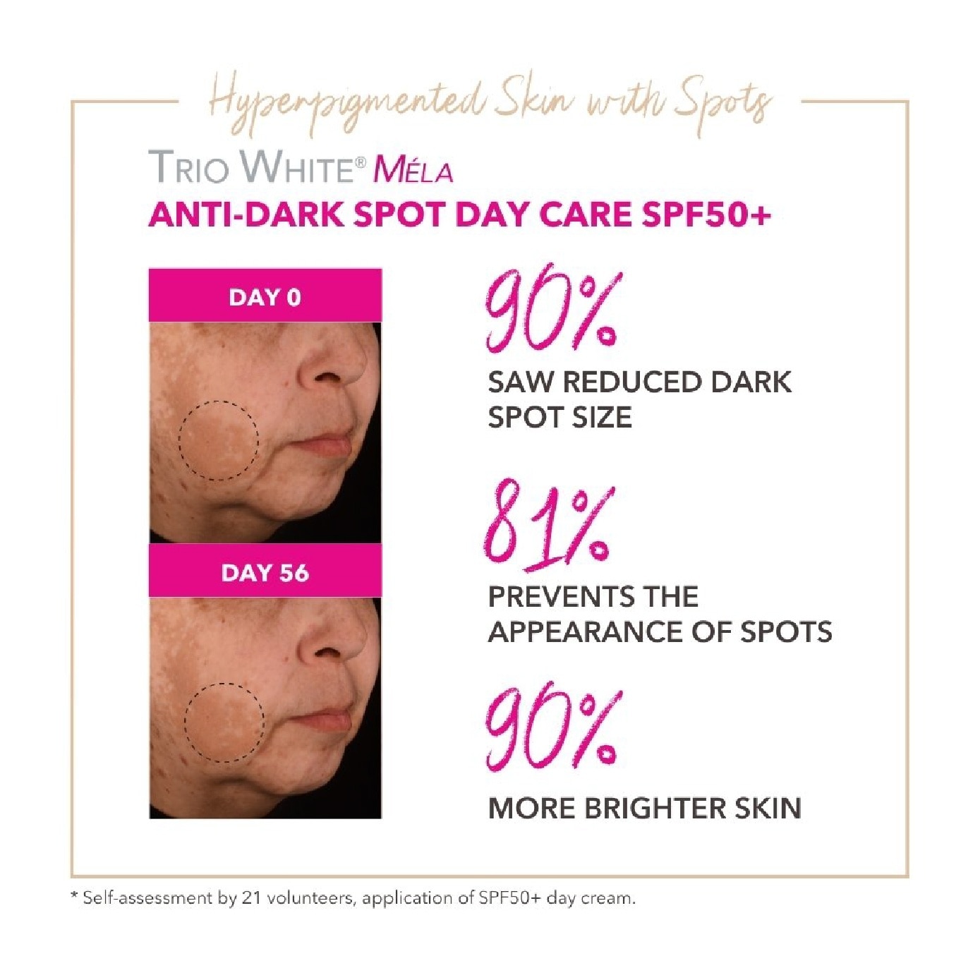 Trio White Mela+ Anti-Dark Spot Day Cream SPF 50+ 40ml